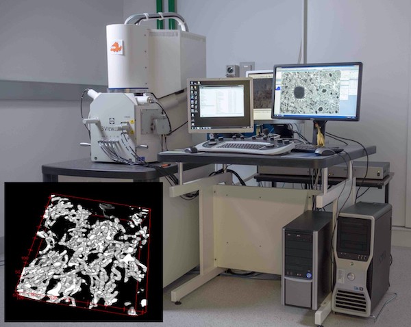 3D SEM (Zeiss) with 3View System (Gatan) at CMM. Inset: reconstructed 3D Mitochondria network highlighting the complexity of mouse liver cells ‘energy supply organelle’ (biopsy). (Photo courtesy of CMM.)